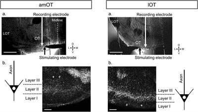 Synaptic plasticity and roles of orexin in distinct domains of the olfactory tubercle